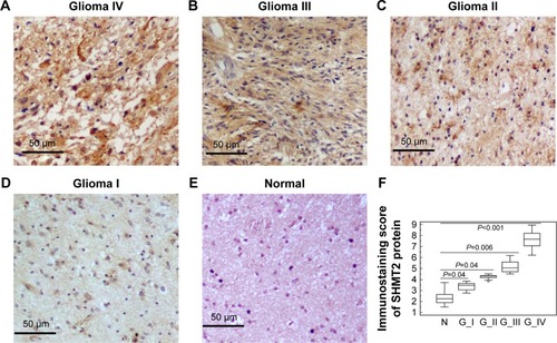 Figure 1 Expression pattern and subcellular localization of SHMT2 protein in human glioma and non-neoplastic brain tissues examined by immunohistochemistry.