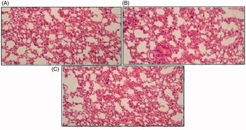 Figure 12. Histological slides of lung of rabbit of control group I (A), after oral solution of 5-FU-MMWCH-NPs treated group II (B) and 5-FU-MMWCH-NPs treated group III (C).