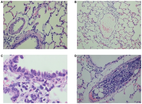 Figure 6 Histology slides of pulmonary tissue at 6 hours and 24 hours sham and post-injury. A) Normal alveolated lung parenchyma with normal bronchiolar vascular structures (400 × H &E), B) Perivascular leukocyte infiltration at 6 hours after femur fracture, Grade II (200 × H &E), C) Peribronchiolar leukocyte infiltration at 24 hours after femur fracture, Grade I (1000 × H &E), and D) Bone marrow embolus filling vascular lumen (H&E stain 400 ×).
