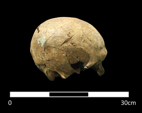 Figure 12. Sharp force trauma on the right parietal across the coronal suture of Sk481. Photo: K. Tait.