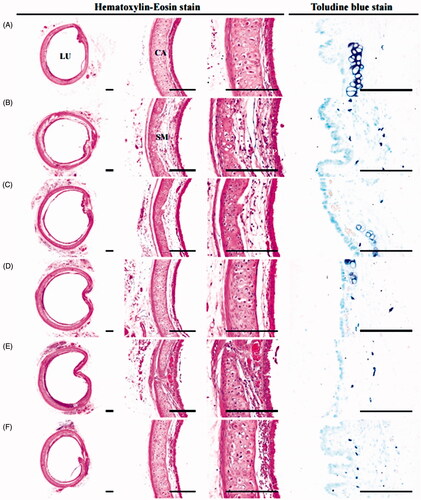 Figure 3. Representative histological images of ear during anti-inflammatory assay. (A) Intact vehicle control: Vehicle (distilled water) treated intact control mice. (B) Xylene control: Vehicle administered and xylene topically applied control mice. (C) DEXA: DEXA 1 mg/kg administered and xylene topically applied mice. (D) KOG100: KOG 100 mg/kg administered and xylene topically applied mice. (E) KOG200: KOG 200 mg/kg administered and xylene topically applied mice. (F) KOG400: KOG 400 mg/kg administered and xylene topically applied mice. KOG: Kyeongok-go, Traditional mixed herbal formulation. DEXA: Dexamethasone; AS: Anterior surface; EP: Epidermis; DE: Dermis; CA: Cartilage. Scale bars = 120 µm.