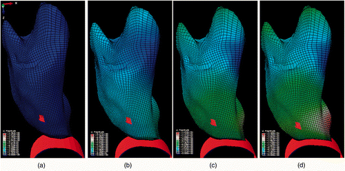 Figure 5. Results of FE simulation. The projection of the tumor area inside the lung is highlighted on the surface. The panels show the undeformed lung (a) together with three samples from the lung deformation field sequence (b–d) for a complete phase of simulated respiration.