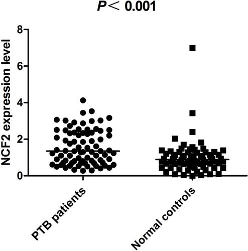 Figure 1 The NCF2 mRNA level in PBMCs from PTB patients and healthy controls.
