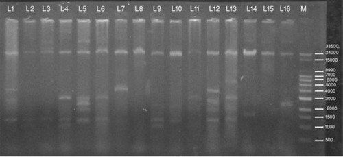 Figure 2 Separation of plasmid DNA molecular weight on agarose gel stained with ethidium bromide (lanes 1–16: plasmid DNA of clinical isolates of MDR E. coli, lane (M) marker DNA – 33.5 kb DNA ladder).