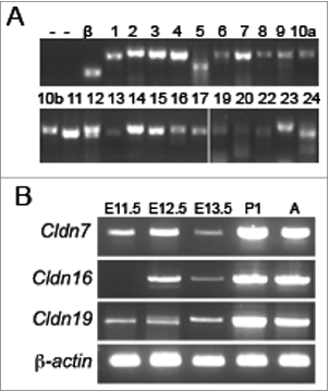 Figure 1. Temporal Expression Analysis of Claudins during Mouse Kidney Development. (A) RT-PCR analysis of all claudin family members in E13.5 mouse kidneys. β-actin (β) was used as a positive control and RT-PCR reactions without the addition of RNA (lane 1) or with inactivated reverse transcriptase (‘—’; lanes 1 and 2) served as negative controls. The claudin family member is listed above each lane. Cldn18 was not amplified (data not shown). All RT-PCR amplicons were sequenced to confirm identity. (B) RT-PCR analysis of Cldn7, Cldn16, and Cldn19 at different stages of kidney development. β-actin was amplified as an internal control. Cldn7 and Cldn19 mRNA transcripts are expressed from embryonic day (E) 11.5 onwards, whereas Cldn16 mRNA transcripts are expressed from E12.5 onwards.