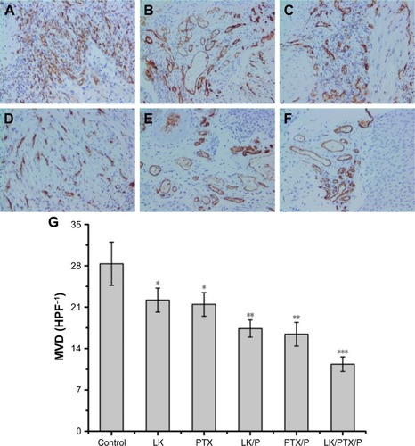 Figure 8 CD34 expression and MVD in the rat bladder cancer tissue.Notes: (A) Control; (B) LK; (C) PTX; (D) LK/P; (E) PTX/P; (F) LK/PTX/P; (G) MVD. Immunohistochemical staining, magnification ×200. Data are expressed as the mean ± SD, n=10. *p<0.01 vs Control, **p<0.05 vs LK or PTX, ***p<0.01 vs LK/P or PTX/P.Abbreviations: HPF, high-power field in an optical microscope; LK, lumbrokinase; MVD, microvessel density; P, PEG-b-(PELG-g-(PZLL-r-PLL)); PEG-b-(PELG-g-(PZLL-r-PLL)), poly(ethylene glycol)-b-(poly(ethylenediamine l-glutamate)-g-poly(ε-benzyoxycarbonyl-l-lysine)-r-poly(l-Lysine)); PTX, paclitaxel.