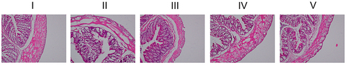 Figure 6 The Effect of NC-CS/PT-NPs on Colon Pathology in NAFLD Mice (HE staining; ×200).