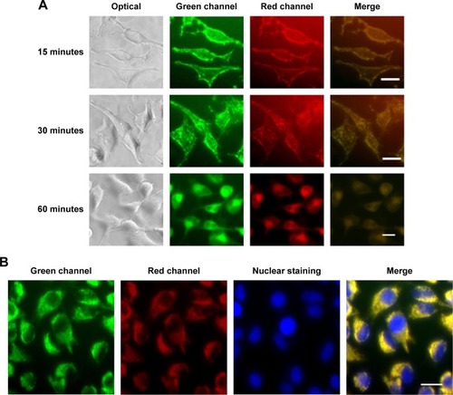 Figure 2 Cell uptake of the nanocapsules in Hela cells.Notes: (A) Cell uptake process of the nanocapsules consisted of FITC–BSA coating and TRITC–BSA core. (B) Fluorescence images under confocal microscope after 60 minutes of incubation. Nuclei were stained with Hoechst 33258 (blue). Scale bar 20 μm.Abbreviations: FITC–BSA, fluorescein isothiocyanate–bovine serum albumin; TRITC–BSA, tetramethylrhodamine–bovine serum albumin.