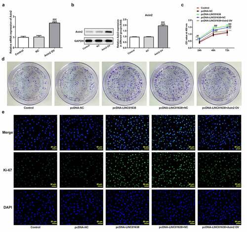 Figure 6. LINC01638 overexpression regulates TPC-1 cell proliferation, migration, invasion and cell cycle via Axin2. The mRNA (a) and protein expression (b) of Axin2 in TPC-1 cells transfection with Axin2-overexpressed vectors were detected by qRT-PCR and western blot assay, respectively. Cell proliferation was estimated by CCK-8 assay (c) and colony formation assay (d) after transfection with pcDNA-LINC01638 in the presence and absence of Axin2 OV. E, Immunofluorescence assay was employed to evaluate the level of Ki67 in TPC-1 cells. Data are expressed as mean ± SD. ***P < 0.001 versus control; #P < 0.05, ##P < 0.01, ###P < 0.001 versus respective NC groups. ΔΔP < 0.01 versus pcDNA-LINC01638+ NC