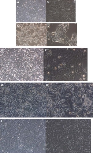 Figure 1 Photomicrographs showing morphological and immunohistochemical properties of different cell lines.