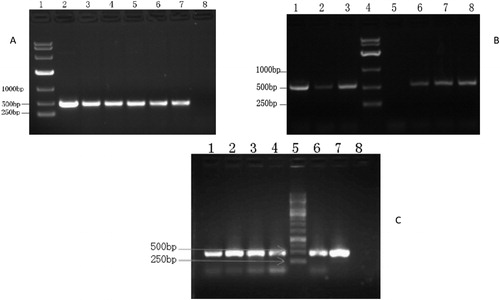 Figure 3. RT-PCR of transgenic plants. (A) RT-PCR of plants from transgenic plant lines KLine13 and KLine15. lane1, DNA Marker (DL10000 DNA Marker, Takara Bio Inc., Beijing.); lanes 2, 3 and 4, KLine13; lanes 5, 6 and 7, KLine15; lane 8, WT N. tabacum variety K326. (B) RT-PCR of plants from transgenic plant lines BLine25 and BLine26. lanes 1, 2 and 3, BLine25; lane 4, DNA Marker (DL10000 DNA Marker, Takara Bio Inc., Beijing); lane 5, WT N. benthamiana; lanes 6,7 and 8, BLine26. (C) RT-PCR of plants from transgenic plant line KLine12. lanes 1, 2, 3, 4 and 6, KLine12; lane 5, DNA Marker (GeneRuler 1 Kb DNA Ladder, Thermo Fisher Scientific Company, China); lane 7, plasmid with BrERF11b gene; lane 8, WT N. tabacum variety K326.