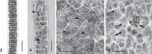 Figs 3–6. Compsopogon caeruleus: photomicrographs of important morphological features for both the ‘caeruleus’ and ‘leptoclados’ morphologies. Location codes as in Table 1. 3. Early cortication of ‘caeruleus’ morphology showing regular cortication. Specimen from BR-ES7. 4. Early cortication of ‘leptoclados’ morphology showing irregular cortication and rhizoidal cells (arrow-heads). Specimen from BR-CL. 5. Surface view of ‘caeruleus’ morphology showing regular (polygonal) cortical cells and monosporangia (arrowheads). Specimen from BR-ES3. 6. Surface view of ‘leptoclados’ morphology showing monosporangia (arrowheads), microsporangia (arrow) and rhizoidal cell (double arrowhead). Specimen from BR-CL. Scale bars = 50μm.