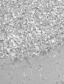 Fig. 6 Autoptic cerebellar cortex. The Purkinje cell layer appears well preserved. EE. Original magnification, × 40.