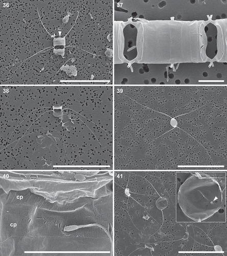 Figs 36–41. Chain and setae types; scanning electron microscopy. Fig. 36. Terminal cell in a chain with a rimoportula (arrowhead) and somewhat thicker end setae, a specimen from the holotype preparation No. B 40 0043102. Fig. 37. Intercalary frustules showing hexagonal, constricted windows and epicingulae; central sibling-cells, after mitotic division. Note lack of rimoportulae on the intercalary valves. Fig. 38. Sibling valves joined by fused heavy intercalary setae. Note that these setae are not undulated. Fig. 39. Two sibling valves showing Brunel Group II type of setal divergence. Fig. 40. Close up of copulae (cp) showing their ornamentation. Sperm-like object on surface of band (and visible in other figures) is most likely a Caulobacter-like bacterium commonly found in marine waters and diatom cultures. Fig. 41. Circular post-sexual valve with imperfect setae and misplaced rimoportula (shown as enlarged insert; arrowhead). Scale bars: Figs 36, 38, 39, 41, 40 µm; Figs 37, 40, 5 µm.