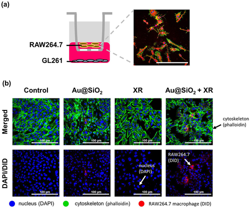 Figure 4 The effect of GL261 cells receiving Au@SiO2 NPs and X-ray irradiation (XR) on the chemotactic migration of RAW264.7 macrophages.