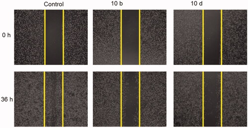 Figure 5. Effect of compounds 10b and 10d on A549 cells migration. Scratch wound healing assay was used to analyse the inhibition of cell migration in A549 cells treated for 36 h with either 10b or 10d and the untreated cells served as a negative control. Representative images of scratched areas in confluent A549 cell layers.