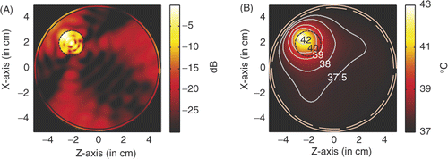 Figure 18. Power and temperature distribution of hyperthermia of a 20 mm tumour with 6 GHz microwave: (A) Power deposition, and (B) Temperature distribution.