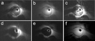 Figure 1. Comparison of different fast imaging sequences in vivo.
