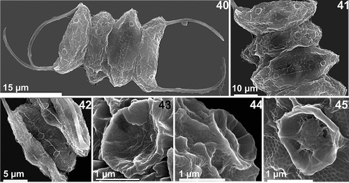 Figs 40-45. Scanning electron microscopy of the AICB 1155 strain. Figs 40, 41. Cells are displayed linearly and rosettes are visible over the cell surface and at the cell Poles. Fig. 42. Rib-like structures can be seen along the cell wall, interrupted by rosettes. Fig. 43. Magnified rosette (side view) with visible bristles throughout its surface. Fig. 44. Magnified rosette (side view) and tubular structures that protrude through the honeycomb net. Fig. 45. Magnified rosette (front view) with mushroom-like structures at the bottom and visible honeycomb mesh.