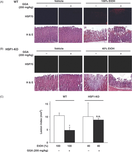 Figure 2. Effect of ethanol and/or GGA on expression of Hsp70 and production of gastric lesions. Wild-type (WT) (A, C) and HSF1-null (HSF1-KO) (B, C) mice were orally pre-administered 200 mg/kg GGA (10 mL/kg as emulsion with 5% gum arabic), 1 h after which they were orally administered with the indicated doses of ethanol. After 4 h, sections of gastric tissues were prepared and subjected to histological examination (H&E) and immunohistochemical analysis with an antibody against Hsp70 (A, B). After 4 h, the stomach was removed and scored for haemorrhagic damage. Values are mean ± SEM (n = 3–6). *P < 0.05. n.s., not significant (C). This figure was published previously and is reprinted here with permission of the journal Citation[21].