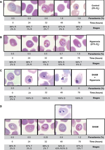 Figure 1 Morphologic alterations of Plasmodium falciparum following salicylhydroxamic acid (SHAM) pressure. Phenotypic changes of P. falciparum asexual blood stages were observed during two parasite cycles under (A) normoxia, (B) hyperoxia (ie, 21% oxygen), (C) SHAM/hyperoxia conditions, and (D) SHAM pressure. The parasitemia and parasitic stages were evaluated by blood smears at 0, 24, 32, 48, and 78 hours. After SHAM addition following hyperoxic exposure, significant morphological alterations were observed during the two cycles of parasites. The different intraerythrocytic stages and their corresponding percentages are indicated as follows: ring (R), trophozoites (T), schizonts (S), and parasite’s death (D).