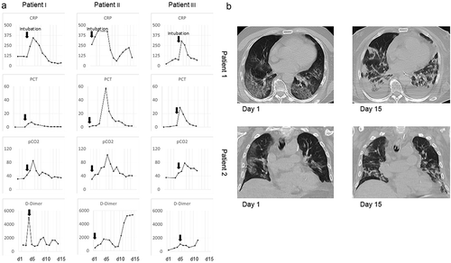 Figure 4. Time course of laboratory results and CT-findings obtained from ARDS patients.