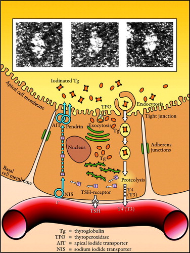 Figure 1.  The thyroid follicle cell with iodinated thyroglobulin molecules (Electron microscopy: G Berg). With kind permission from Nycomed AB and authors.