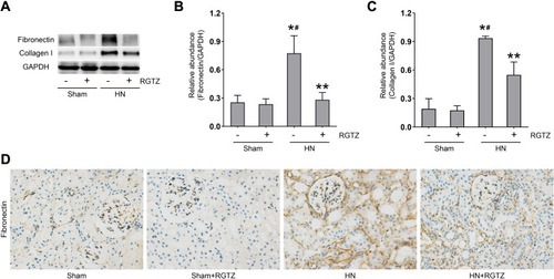 Figure 3 RGTZ decreases fibronectin and collagen I expression in the kidneys of HN rats. (A) Kidney tissue lysates were subjected to immunoblot analysis with specific antibodies against fibronectin, collagen I, or glyceraldehyde 3-phosphate dehydrogenase (GAPDH). (B) Expression levels of fibronectin were quantified by densitometry and normalized to GAPDH. (C) Expression levels of collagen I were quantified by densitometry and normalized to GAPDH. (D) Photomicrographs (original magnification, ×400) illustrate immunohistochemical fibronectin staining of the kidney tissues. RGTZ, rosiglitazone. Data are represented as the mean ± SEM. *p < 0.05 vs sham group; #p < 0.05 vs sham + RGTZ group. **p < 0.05 vs HN group.