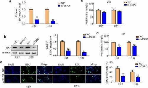 Figure 2. Inhibition of TSPO suppressed the proliferation of U251 and U87 cells. (a) Transfected efficiency of targeting TSPO siRNA of U251 and U87 cells was detected through qRT-PCR. (b) Transfected efficiency of targeting TSPO siRNA of U251 and U87 cells was detected through Western blotting. (c) CCK-8 assay was used to detect the proliferation of U87 and U251 cells with TSPO inhibition in 24 h. (d) CCK-8 assay was used to detect the proliferation of U87 and U251 cells with TSPO inhibition in 48 h. (e) The EDU assay showed that decreased TSPO expression inhibited the proliferation of U87 and U251 cells. ** P < 0.01.