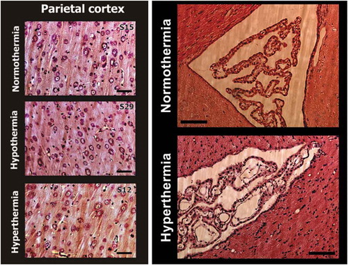 Figure 16. Temperature dependence of structural brain changes. Left pictures show Nissl-stained sections from similar areas of the deep parietal cortex obtained from rats maintained at different levels of NAc temperature (S15 = 36.05°C; S29 = 32.30°C; S12 = 41.80°C). Brain cells during hyperthermia have larger somata and wider axons (arrows) compared to those in normothermia. In contrast, during hypothermia cells are slightly smaller in size, staining is more condensed, and axons are smaller in diameter compared to normothermic conditions (arrows). Bar for each graph is 100 μm. Right pictures show profound changes in structural integrity of the choroid plexus during extreme hyperthermia. All slices were made over lateral ventricles, stained with Hematoxylin-Eosin, and images are shown with equal magnification (bar = 200 μm). In contrast to the healthy structure in normothermic conditions, robust disintegration of epithelial cells and profound vacuolization were typical of hyperthermic conditions. Modified from reference [Citation158].