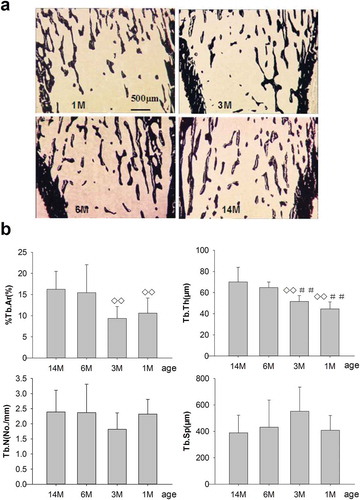 Figure 5. (a) Effects of bone structure and trabecular mass on PTM in rats of different ages. 1M: 1 month old, 3M: 3 months old, 6M: 6 months old, 14M: 14 months old. Slender and interlacing trabeculae were found in 1- and 3-month-old rats. Cancellous bone mass was increased and trabeculae were thickened in 6-month-old rats compared with 1- and 3-month-old rats. Meanwhile, slight increases in cancellous bone mass were seen for 14-month-old rats compared to 6-month-old rats (silver nitrate stain, 4×; trabecular in black stain). Quantitative measurements of static parameters are shown in Figure 5b. (b) Static parameters of %Tb.Ar, Tb.Th, Tb.N and Tb.Sp, on the proximal tibia in rats of different ages. Data are expressed as means ± SD (n = 6) in each group. %Tb.Ar, percent trabecular area; Tb.Th, trabecular thickness; Tb.N, trabecular number; Tb.Sp, trabecular separation. %Tb.Ar, Tb.Th and Tb.N increased progressively, whereas Tb.Sp reduced gradually with aging. Vs. 14-month-old, ◊◊ P < 0.01; vs. 6-month-old, ##P < 0.01, Student’s t-test. PTM, the proximal tibial metaphyses; Tb.Ar, trabecular area; Tb.Th, trabecular thickness; Tb.N, trabecular number; Tb.Sp, trabecular separation. 1M: 1-month-old, 3M: 3-month-old, 6M: 6-month-old, 14M: 14-month-old.