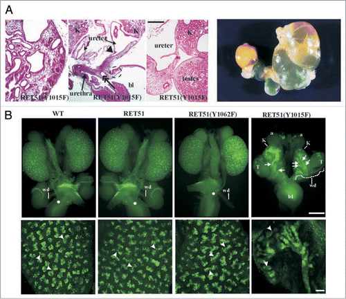 Figure 5 Complex CAKUT phenotype RET51(Y1015F) due to supernumerary ureters and decreased branching. (A) Histological and gross features of RET-Y1015F-PLCγ signaling mutant. The H&E-stained pictures at P0 show cystic hypodysplastic kidney (left), dilated ureters and possible distal stricture (middle) and failure of testes to separate from the urinary system (right). The gross photograph shows massive megaureter/hydroureter and barely any recognizable kidney parenchyma in 4 week old RET(Y1015F) mutant mice. (B) Whole mount Dolichos Biflorus Agglutinin-FITC (DBA-FITC) staining of E15.5 kidneys. Top, Normal honeycomb pattern of ureteric bud branching, single ureters entering the bladder (white dot), and separation of Wolffian duct (wd) from the ureter was evident in kidneys (K) of mice expressing WT, RET51 and RET51(Y1062F). In RET51(Y1015F) animals, note bilateral small kidneys with supernumerary UBs (arrows) that enter the mesenchyme but show decreased branching and failed to separate from the wd (white dashed line). The testes (T) were also abnormally positioned. Bottom, Imaging of the above kidneys by confocal microscopy clearly depicts the dramatic deficit in branching morphogenesis (arrowheads indicate branch points) in homozygous RET51(Y1015F) kidneys. Scale bar: 100 µm. Adapted and modified from Jain et al.Citation42 with permission.