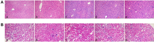 Figure 8 Histopathological changes in each group. (A) Pathological tissue of APP/PS1 mice liver; (B) pathological tissue of APP/PS1 mice kidney. (a) CG; (b) MG; (c) HG; (d) LG; (e) PG. (HE staining, ×200).
