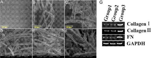 Figure 1. Cell adhesion and extension on PGA in vitro and mRNA expression of collagen type I, collagen type III and FN. (A–C) Phase-contrast photographs of PDL cells cultured in DMEM supplemented with 10% FBS for 6 days (A) or cultured on PGA polymer fibres in DMEM supplemented with 10% FBS for three days (B) and seven days (C). (D–F) SEM of unseeded PGA scaffolds (D) and PGA fibres seeded with PDL cells for 7 days (E, F). (G) mRNA expression of collagen type I, collagen type III and fibronectin (FN) in primary PDL cells (Group 1), unseeded fourth passage cells (Group 2) and PDL cells within PGA scaffolds (Group 3).