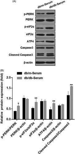 Figure 1. Serum from DN mice induced podocyte injury and endoplasmic reticulum stress. (A) MCP5 podocytes were treated either with 10% serum from control C57BL/KsJ dm/m mice or with 10% serum from C57BL/KsJ dm/dm DN mice for 24 h. Western blot image showing activation of PERK-eIF2α-ATF4 in ER stress signaling pathway and increased apoptosis-related molecule cleaved caspase-3 in podocytes treated with serum from DN mice as compared to control mice. (B) Densitometric quantification of protein expression from Figure 1(A). (**p < 0.01, *p < 0.05).