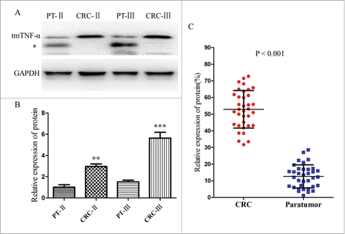 Figure 2. Different levels of tmTNF-α expression in human CRC and Paratumor (PT) tissues by Western blotting assay. (A) the electrophoresis on 15% PAGE of tmTNF-α from the paired CRC and PT tissues of stageIIand III, GAPDH was used as an internal control. The bands below may be the subunit sheared from tmTNF-α (*). (B) the relative ratio of tmTNF-α expression in CRC of stageIIor III was 3.15 or 5.6-fold than that of the PT tissue, respectively, and the difference were statistically significant (**, P < 0.05; ***, P < 0.001). (C) extracting tissue total protein of 35 cases of CRC and corresponding PT tissues selected randomly, Western blotting was performed to analysis the tmTNF-α expression, and the relative amount (%) of tmTNF-α of CRC tissues was obviously higher than that of the corresponding PT. The relative values of all results were determined and expressed as mean ± SD of 3 experiments induplicate (P < 0.001).
