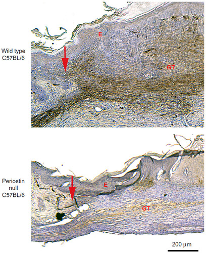 Figure 2 α-Smooth muscle actin expression is significantly reduced in periostin knockout mice compared with wild-types at 7 days postwounding. Red arrows mark the wound edge.