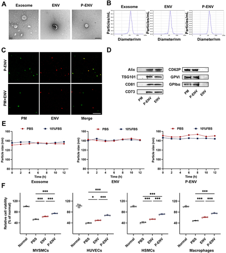 Figure 1 Fabrication and characterization of P-ENV. (A) Representative TEM images of exosome, ENV and P-ENV. Scale bar = 200 nm. (B) Size distribution of exosome, ENV and P-ENV by NTA analysis. (C) Colocalization analysis of P-ENV (yellow) or a simple mixture of PM (green) and ENV (red) by confocal fluorescence images. Scale bar = 20 um. (D) Western blot analysis of Alix, TSG101, CD81 and CD73 expression or CD62P, GPVI and GPIbα expression in platelet membrane (PM), ENV and P-ENV. (E) The particle sizes of exosome, ENV and P-ENV after incubation with PBS or serum. (F) Relative cell viability as evaluated by CCK-8 assay after various treatments. n = 3. All data are presented as mean ± SD (*P < 0.05, ***P < 0.001).