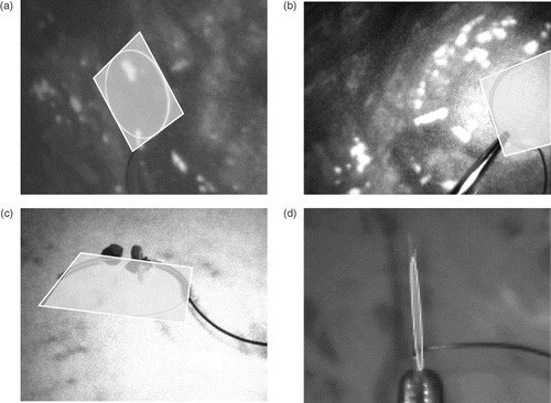Figure 8. Augmented visualization examples. (a) Example visualization of the needle showing the detected ellipse and the plane. (b) Needle held by gripper. (c) Example showing partial occlusion during the suturing process on a phantom mock-up. (d) Degenerate case with the needle plane being almost perpendicular to the image plane.