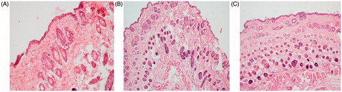 Figure 7. Histopathology of skin sections treated with (A) conventional cream, (B) EMV gel, and (C) ethosomal gel.