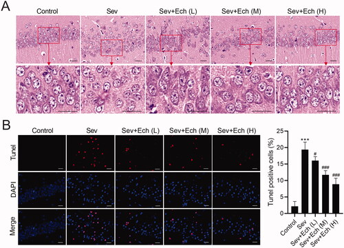 Figure 5. Ech mitigates Sev-induced hippocampal neuronal apoptosis in rats. (A) The cell morphology of neurons in hippocampal CA1 region of rats was assessed by HE Staining. (B) The apoptosis of neurons in hippocampal CA1 region was assessed by Tunel assay. Compared with the control group, ***p < 0.001. Compared with the Sev group, #p < 0.05, ###p < 0.001.