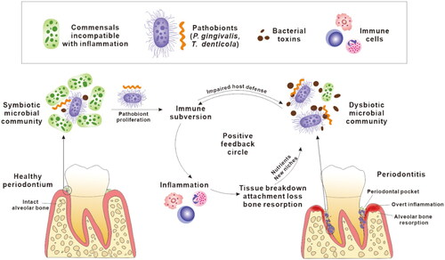 Figure 1. A positive feedback cycle in the pathogenesis of periodontitis. Pathobionts colonise subgingival niches, subvert host immune responses and proliferate, which leads to dysbiosis in the microbial community. The dysbiotic microbial community, characterised by overgrowth of a small number of pathobionts and overproduction of bacterial toxins, persistently stimulates local inflammatory responses. Inflammatory tissue breakdown in turn produces nutrients, including peptides, haem and ferrous iron, that further facilitate the proliferation of pathobionts. This also results in periodontal pockets deepening providing more suitable habitat for pathobionts. Collectively, the dysbiotic microbiota and inflammation share a mutually supportive relationship which is presented as a positive feedback cycle in the development of periodontitis.
