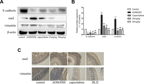 Figure 6 HLJ2 inhibited EMT in AOM/DSS-induced CAC mice. (A) The expression levels of E-cadherin, snail, and vimentin in colons of all groups as determined by Western blot. HLJ2 significantly up-regulated the expression of E-cadherin and down-regulated the expression of snail and vimentin in AOM/DSS-induced CAC mice. (B) Quantitative analysis of Western blot results. (C) Immunohistochemical staining of snail and vimentin in colons of all groups (100×). **P < 0.01 compared with control group; #P < 0.05, ##P < 0.01 compared with AOM/DSS group. Mean values ±  SEM are shown (n=3).
