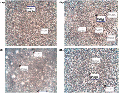 Figure 6. Representative photomicrographs of the SLM formulations. Batches A1, B1 and C1 are gentamicin-loaded SLMs while batch D1 is the unloaded (zero-drug) SLMs.
