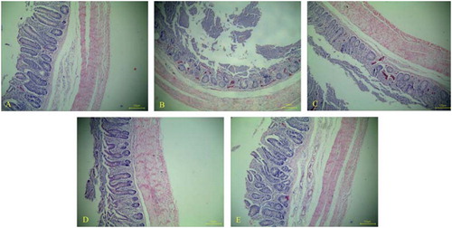 Figure 7. Histopathological lesions in caecum of chickens in each group on day 7 post challenge, stained with haematoxylin and eosin (HE). Caeca sections from chickens in unchallenged control group showing no obvious histopathological changes, and intestinal villi were regularly arranged (A, ×100). For caecum tissues in challenged control group (B, ×100) and vector control group (C, ×100), the structure of intestinal villi were broken, and a large number of red cells and infiltrated inflamed cells were observed. The histopathological changes in caecum of chickens orally treated with 3-1E-expressing (D, ×100) and DCpep-3-1E-expressing (E, ×100) lactococci were both relatively moderate.