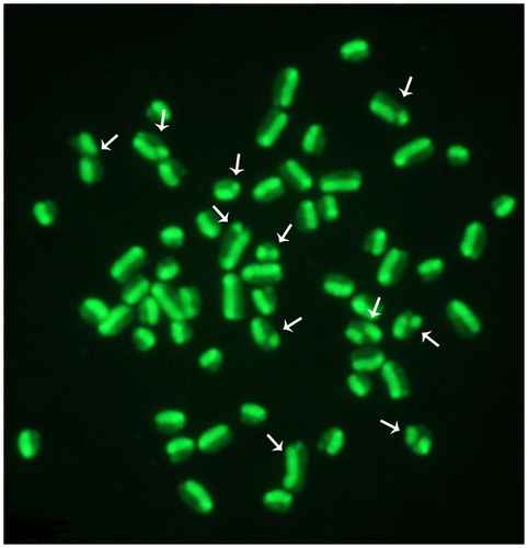 Figure 3. Female cattle metaphase plate showing several SCEs (arrows). Slides were stained with acridine orange and later observed under a fluorescence microscope connected with a digital camera.
