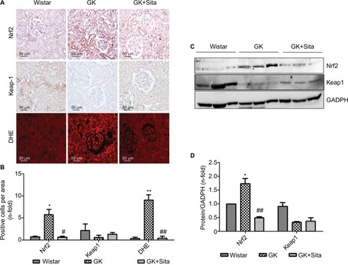 Figure 5 Oxidative stress markers in the GK model. (A) Immunostaining for Nrf2, Keap-1 and DHE in the kidney from Wistar, GK and GK+Sita rats at 9 months (n=6). Original magnification: 20×. (B) Values were represented in graphic as positive cells per area. Data were mean±SEM. *p<0.05 Wistar vs. GK, #p<0.05 GK vs. GK+Sita. ##p<0.01 GK vs. GK+Sita (C) Representative western blot of Nrf2 and Keap-1 as mean ± SEM of n=6 rats. (D) Results of total protein expression were obtained from densitometry analysis and expressed as the ratio protein/GADPH as n-fold over Wistar. *p<0.05 GK vs. Wistar; ##p<0.01 GK vs. GK+Sita.