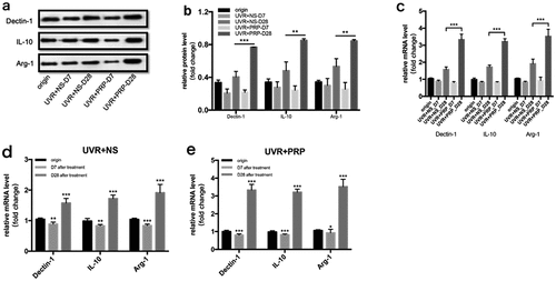 Figure 9. Changes of Dectin-1, IL-10 and Arg-1 expression in rat skin at 7 and 28 days in NS and PRP treated group. a. Representative images of western blots of Dectin-1, IL-10 and Arg-1 protein in NS and PRP treated group at different time points. b. Quantitative protein levels of Dectin-1, IL-10 and Arg-1 are shown. c. The expression of Dectin-1, IL-10 and Arg-1 mRNA at different points and statistical analysis between groups. **p < 0.01 and ***p < 0.001. d,e. The expression of Dectin-1, IL-10 and Arg-1 mRNA at different points and statistical analysis in groups. *p < 0.05, **p < 0.01 and ***p < 0.001 vs. origin group