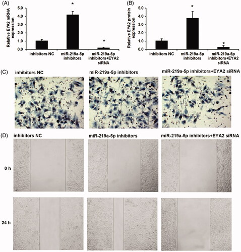 Figure 5. Silenced miR-219a-5p induced OS cell invasion and migration via EYA2 augmentation. (A) Effects of miR-219a-5p inhibitors and EYA2 siRNA on EYA2 mRNA expression. (B) Effects of miR-219a-5p inhibitors and EYA2 siRNA on EYA2 protein expression. (C) Effects of miR-219a-5p inhibitors and EYA2 siRNA on OS cell invasion. (D) Effects of miR-219a-5p inhibitors and EYA2 siRNA on OS cell migration. Values are expressed as mean ± SD, n = 4; *p < .01 vs. mimics NC group.