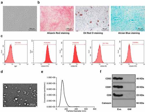 Figure 1. Identification of BMSC-EV. (a) Morphological observation of BMSCs under the microscope (100×); (b) The osteogenic, lipogenic, and chondrogenic differentiation characteristics of BMSCs were identified using Alizarin red, oil red O, and Alcian blue staining respectively; (c) flow cytometry detected BMSCs surface markers CD90, CD105, and CD34, CD45 expression; (d) Transmission electron microscopy of EV morphology; (e) qNano system for the detection of the size distribution of EVs; (f) Western blot analysis of expression of the EV positive markers CD63, CD81, CD9 and the negative marker Calnexin, using the supernatant of BMSC medium after GW4869 intervention as a control. The experiment was repeated three times independently